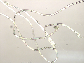 Micro/Macro, Frammento di un’opera di Giulio Paolini 2 al microscopio, Photo © Microcollection