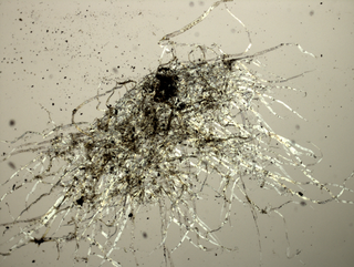 Micro/Macro, Frammento di un’opera di Petra Varl al microscopio, Photo © Microcollection