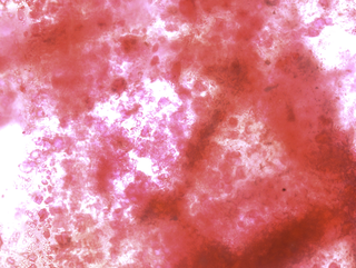 Micro/Macro, Frammento di un’opera di Piero Gilardi al microscopio, Photo © Microcollection