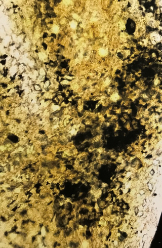 Micro/Macro, Frammento di un’opera di Pipilotti Rist al microscopio, Photo © Microcollection